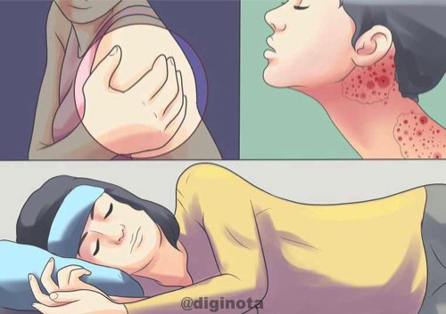 Todo sobre el Chikungunya y cómo recuperarse Todo sobre el Chikungunya y cómo recuperarse 1