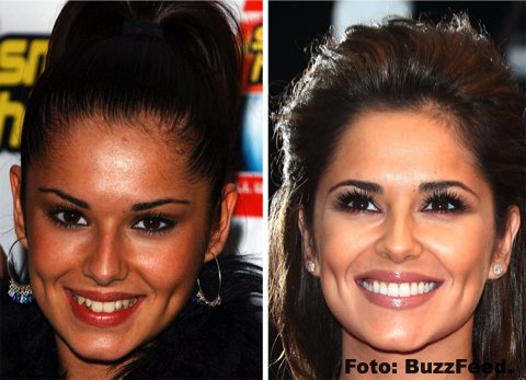 La sonrisa perfecta no siempre fue parte de estos artistas gracias a la ORTODONCIA INSTANTÁNEA 78