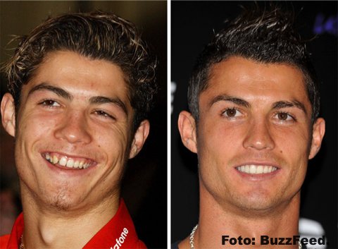 La sonrisa perfecta no siempre fue parte de estos artistas gracias a la ORTODONCIA INSTANTÁNEA 98