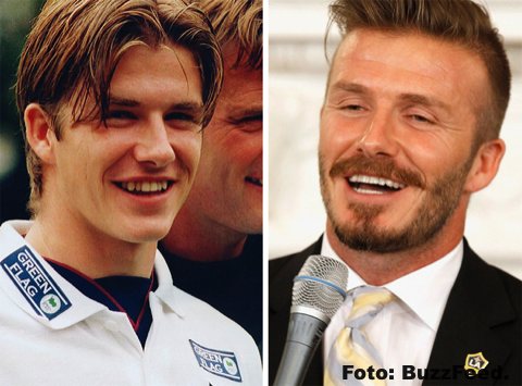 La sonrisa perfecta no siempre fue parte de estos artistas gracias a la ORTODONCIA INSTANTÁNEA 86