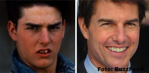 La sonrisa perfecta no siempre fue parte de estos artistas gracias a la ORTODONCIA INSTANTÁNEA 80