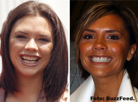 La sonrisa perfecta no siempre fue parte de estos artistas gracias a la ORTODONCIA INSTANTÁNEA 88