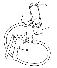 Ilustración de un aparato vacuo constrictor