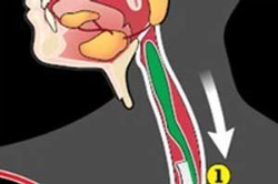 Cepillarse los dientes puede ser peligroso 5