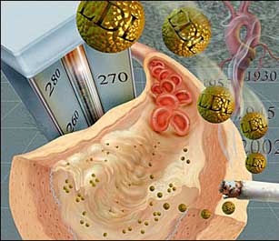 El colesterol bueno reduce el riesgo de ataques de corazón o ictus en pacientes con diabetes 8