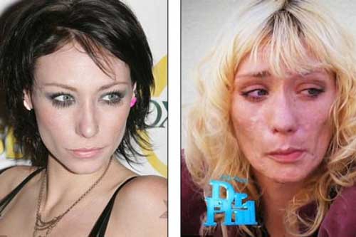 De famosa modelo a desfigurada por las drogas 19