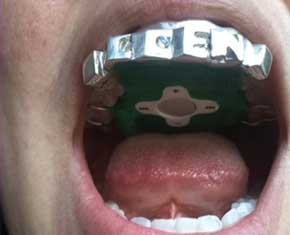 Ahora puedes escuchar música con tus dientes 39