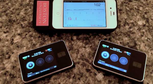 A partir de un iPhone crean un Páncreas que combate la diabetes