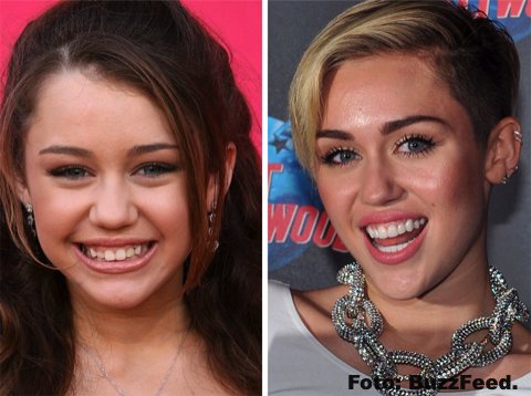 La sonrisa perfecta no siempre fue parte de estos artistas gracias a la ORTODONCIA INSTANTÁNEA