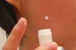eliminar-acne-espinillas-casero-pasta-dental-rapido