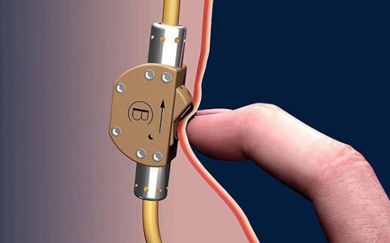 Sperm-Switch-Bimek-SLV-3