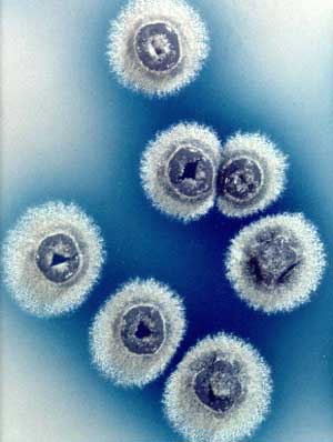  Bacteria Streptomyces coelicolor
