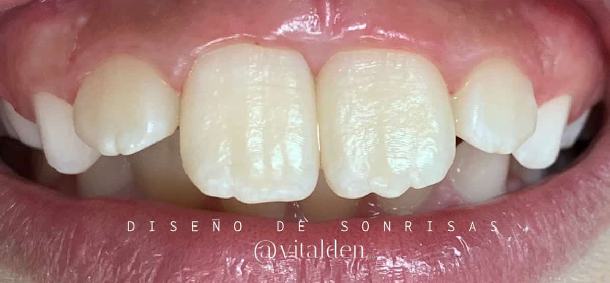 estetica dental