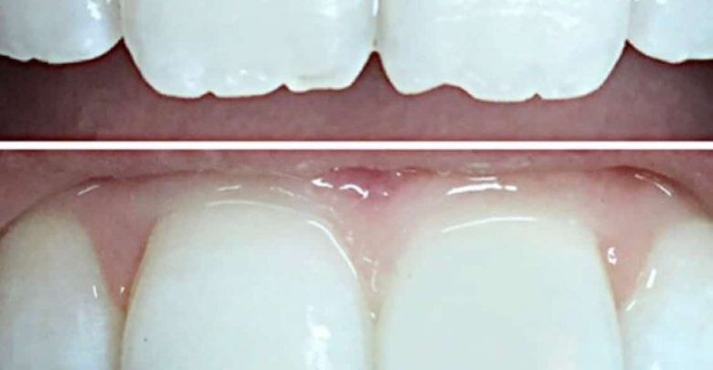 dental mejora la anatomia