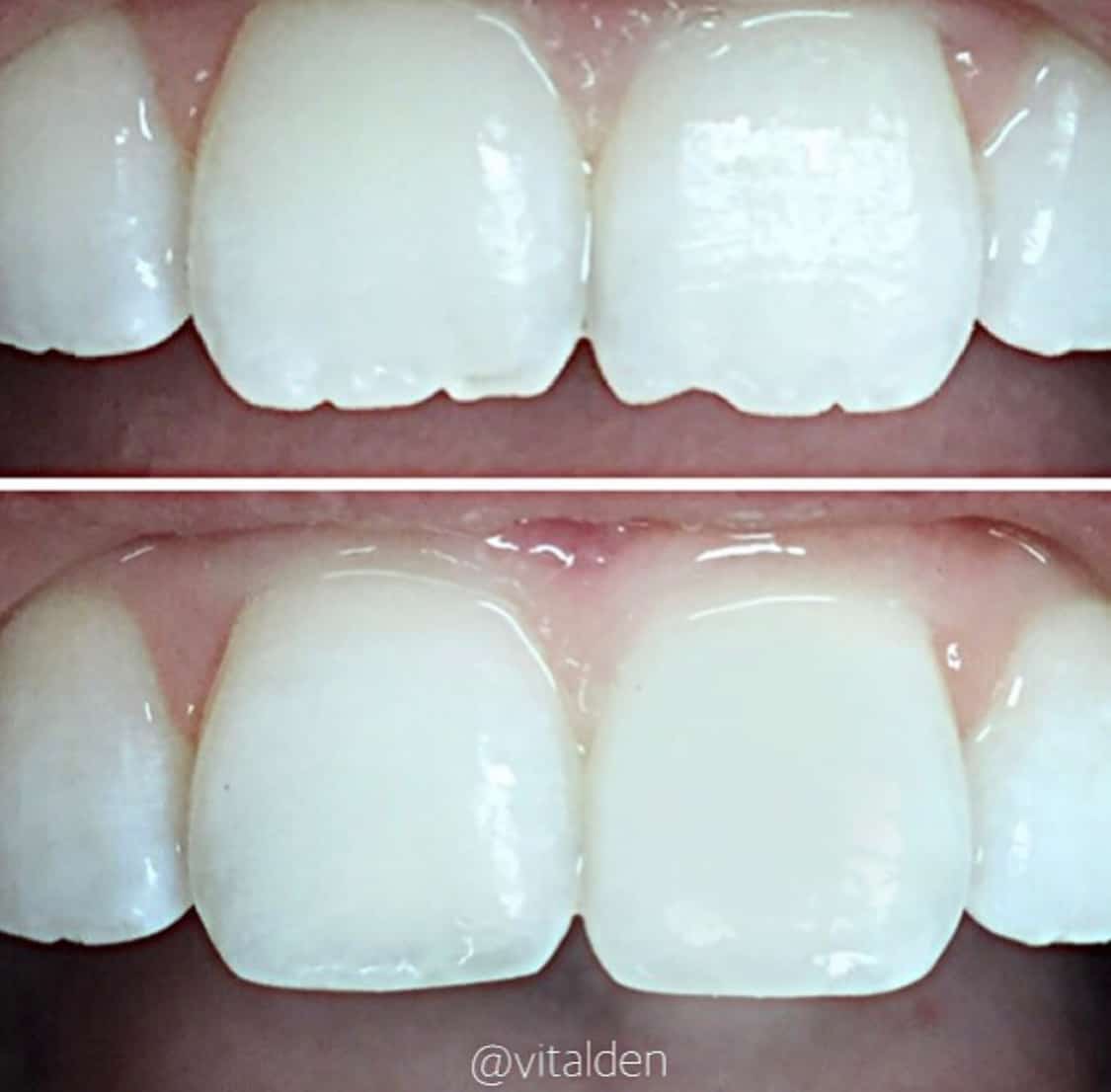 dental mejora la anatomia