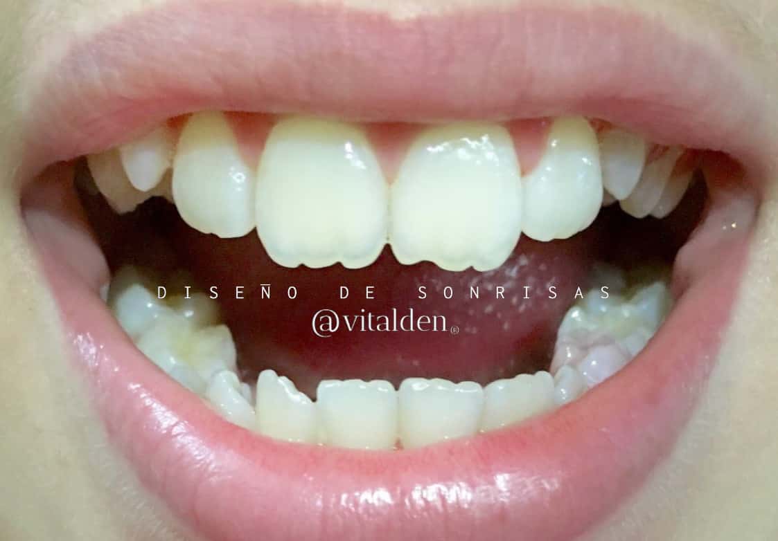 ANATOMÍA DENTAL