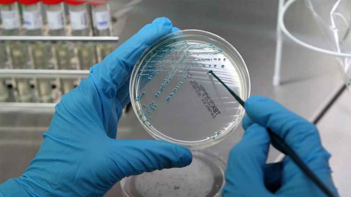 bacteria