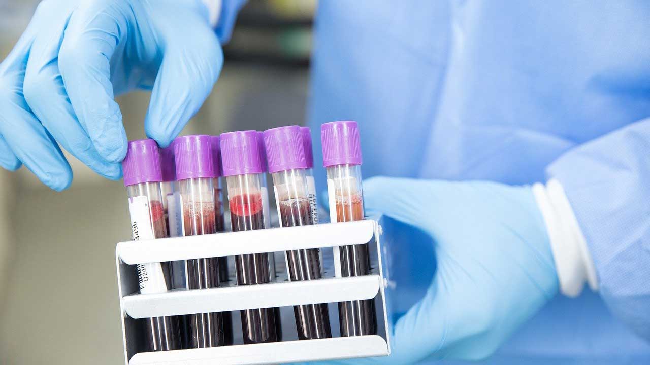 prueba de sangre